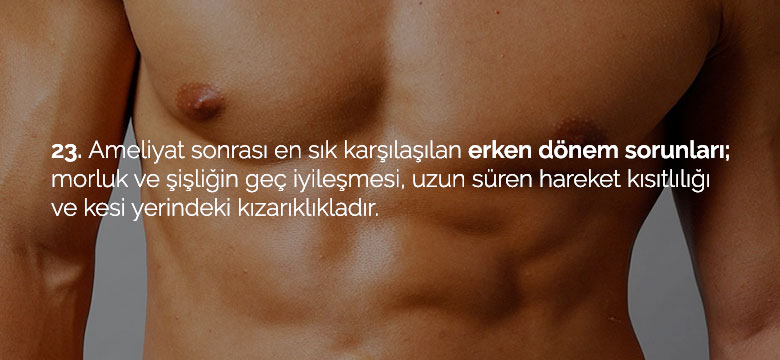 jinekomasti_23