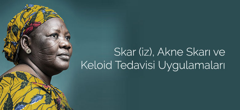skar