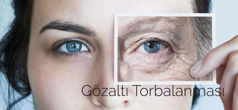 goz_alti_torbalanmasi