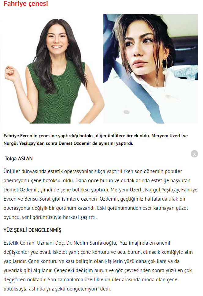 Akşam Gazetesi - Çene Estetiği