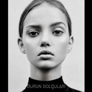 Burun dolgusu nedir, tekrar gerektirir mi