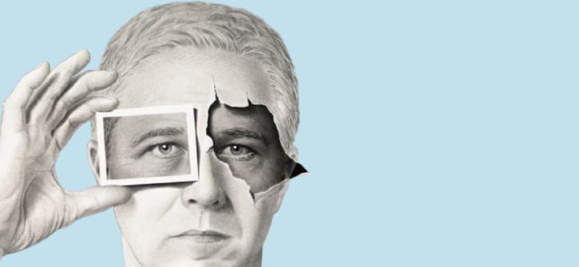 alt göz kapağı estetiği